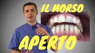 Il Morso Aperto [upl. by Galan]