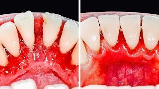 30 ASTUCES POUR LES DENTS QUE TU DOIS CONNAÎTRE [upl. by Ardnaet]