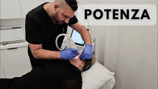 Unlocking Youthful Skin Potenza Microneedling Explained [upl. by Erwin]