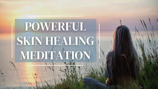 10 Minute Guided Meditation for Healing Skin  Heal Eczema Acne Rosacea Psoriasis [upl. by Paulsen]