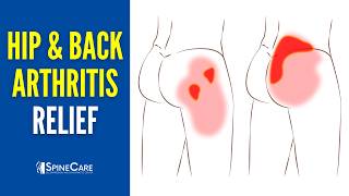 How to QUICKLY Relieve Hip and Back Arthritis Pain [upl. by Nodla473]