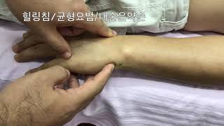 양곡  수태양소장경 阳谷 手太阳小肠经 SI5 Acupuncture Points 힐링침  균형요법  내손은약손 [upl. by Schmitz]