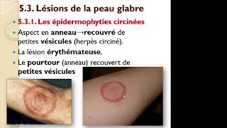 Dermatophytes et dermatophytoses [upl. by Morrie]