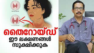 തൈറോയ്ഡ് ഈ രോഗ ലക്ഷണങ്ങൾ സൂക്ഷിക്കുക  Thyroid Malayalam Health Tips [upl. by Akired]