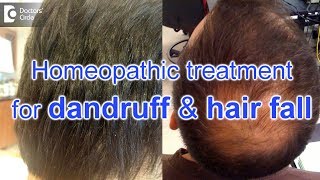 Homeopathic treatment for dandruff and hair fall  Dr Surekha Tiwari [upl. by Oconnor107]