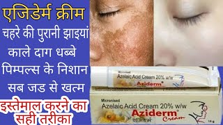 AZIDERM CREAM REVIEW चहरे के काले दाग धब्बे झाइयांएकने पिम्पल्स सब जड से खत्म करने की क्रीम [upl. by Nnadroj]