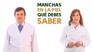 Manchas en la piel ¿Qué debes saber Tu Farmacéutico Informa Dermofarmacia [upl. by Ecydnarb396]