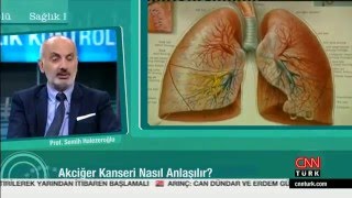 Akciğer Kanseri Cerrahi Tedavisi  CNN Turk [upl. by Eoin]