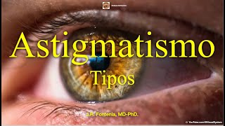 Astigmatismo Tipos [upl. by Akkimat663]