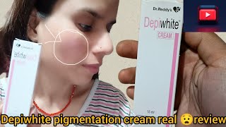 💠👉depiwhite cream pigmentation melasmareal review🫢 daily life vlog video vlog video video 🧿 [upl. by Mayeda705]