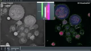 Circulating Tumor Cells A549 detection with 3D microscope [upl. by Leshia]