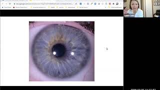 IRIDOLOGY How to do a Clinical Assessment in 20 Minutes or Less [upl. by Carmella]