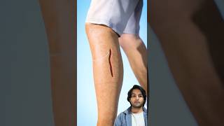 How stitches works Shorts ViralVideo YouTubeShorts TrendingVideo Medical [upl. by Nikral]