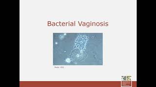 Non Infectious and Recurrent Vulvovaginitis Etiology Epidemiology Diagnosis amp Treatment [upl. by Akimrej51]