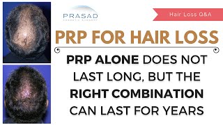 Monthly PRP Hair Loss Injections Have Limited Results  Combo Treatment Lasts Years with 1 Treatment [upl. by Alekahs]