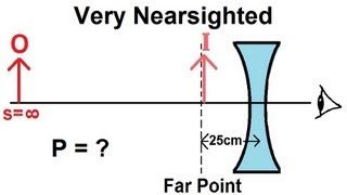 Physics  Optics Vision Correction 3 of 5 Very Nearsighted [upl. by Anayhd]