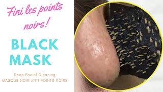 Squeeze acne le moyen le plus populaire pour enlever les points noirs sur Internet blackheads re [upl. by Ruhnke720]