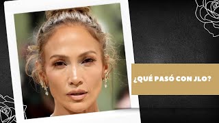 ¿QUÉ PASÓ CON JLO [upl. by Rector]