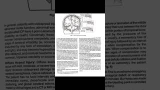 Types of head injury and nursing management of craniotomynursingcraniotomynursing management [upl. by Donadee]