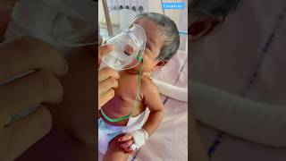 Respiratory Problems Babymedical newbornbaby [upl. by Follansbee]