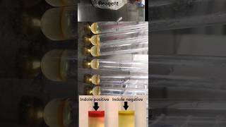 Indole Test biochemical test microbiology [upl. by Odlawso]