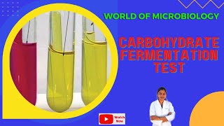 Carbohydrate Fermentation Test Tamil  Identification of Bacteria by Biochemical Test [upl. by Desmond]