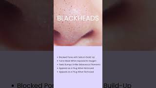 Tired of blackheads Youre not alone Heres the difference between blackheads ampsebaceous filaments [upl. by Waligore]