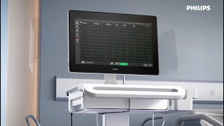 Philips Cardiac Workstation — Tap the power of connected cardiography [upl. by Shaffert]