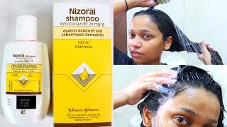 How to use Nizoral shampoo for effective results [upl. by Aldarcy54]