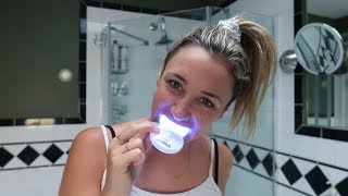 Do athome teeth whitening kits really work  Glam Lab [upl. by Nilesoj]