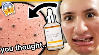 I tried iUNIK PROPOLIS SYNERGY SERUM for ONE WEEK I have to laugh [upl. by Ecnerret]