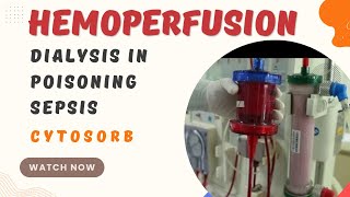 What is Hemoperfusion  Dialysis in Poisoning  Dialysis in sepsis  cytosorb [upl. by Hew]