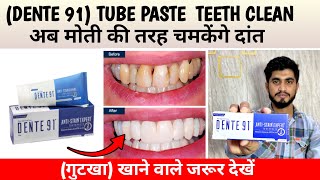 तीन दिन में दांत चमकेंगे मोती की तरह ॥ Dente91 AntiStain Expert Toothpaste  Teeth Cleaning Paste [upl. by Frost]