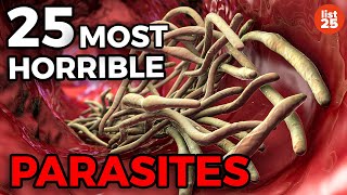 25 Parasites You Do Not Want To Be Infected With [upl. by Ynattyrb]