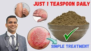 Just 1 Teaspoon Daily To Cure all Your Skin Problems  Eczema  Simple Treatment [upl. by Cozza557]