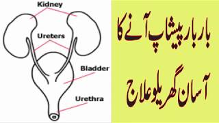 sardi mai peshab ka bar bar anahow to stop bedwettingUrine PROBLEM solutionNO more bedwetting [upl. by Dickman]