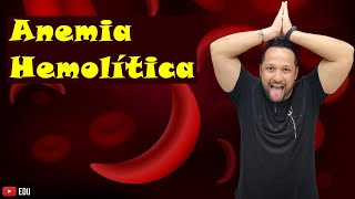 Anemia Hemolítica  Conceito e Exemplos  Tipos de Anemia  Sangue  Fisiologia Humana [upl. by Einot624]