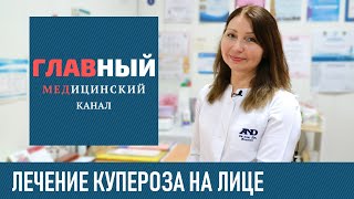 Лечение купероза на лице в домашних условиях Как убрать сосудистые звездочки на лице и теле [upl. by Jacquetta97]