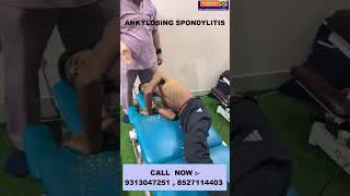 Chiropractic Treatment in Delhi  ANKYLOSING SPONDYLITIS  Dr Varun Chiropractor Call  8527114403 [upl. by Elleniad401]