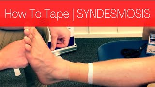 HOW TO TAPE A SYNDESMOSIS HIGH ANKLE SPRAIN [upl. by Eelrebmik]