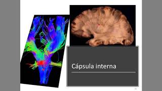 Hemisferios cerebrales  Configuración interna Parte 2 de 3 [upl. by Akahc]