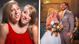 Conjoined Twins Abby and Brittany Hensel Got Married [upl. by Miranda]