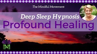 Use Your Powerful Mind Healing Deep Sleep Hypnosis  Mindful Movement [upl. by Enyamrahs]