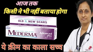 Mederma cream  Mederma for acne scars  Mederma advanced scar gel review [upl. by Ainoloppa321]