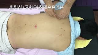 김환자 임상기록20190304  간염 어깨 경추 48편 Acupuncture Points 힐링침  균형요법  내손은약손 [upl. by Matilde698]