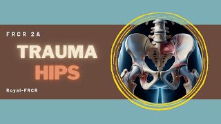 4  MSK amp Trauma Imaging for FRCR [upl. by Nek873]