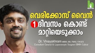 വെരികോസ് വൈൻ മാറ്റാൻ 2 വഴികൾ  varicose veins malayalam health tips [upl. by Payson]