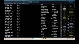 IQ 300 HEMODYNAMIC ECHOPAC ANALYSIS ECHOCARDIOGRAPHY HWD REPORT [upl. by Abba948]