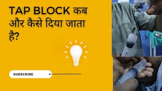 TAP block कैसे लगाते हैंTAP Blockanestesia local anesthesia transabdominal plane block [upl. by Attesoj]