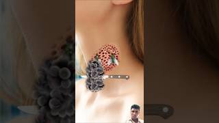 Asmr Neck Infection Treatment Worm Maggots Removal shorts asmr Animation [upl. by Claud273]